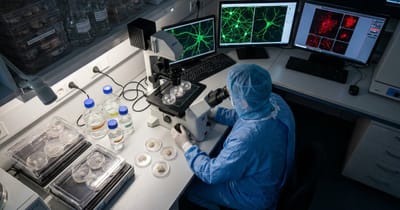 Neues Hirnmodell macht Hoffnung